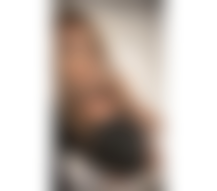 Escorts North Lanarkshire Airdrie - North Lanarkshire - Photos for LORA LORY transgender best serv no rush Best Party 🍡